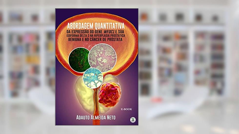 Abordagem Quantitativa da Expressão do Gene WFDC1 e sua Isoforma Delta 3 na Hiperplasia Prostática Benigna e no Câncer de Próstata, do autor Adauto Almeida Neto
