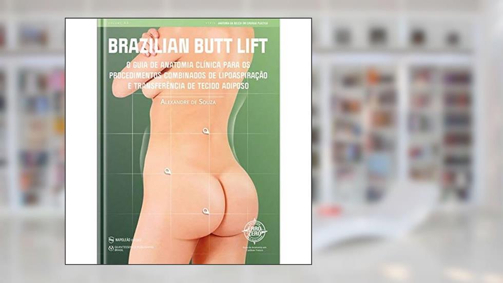 BRAZILIAN BUTT LIFT - O Guia De Anatomia Clínica Para Os Procedimentos Combinados De Lipoaspiração E Transferência De Tecido Adiposo, do autor Alexandre De Souza