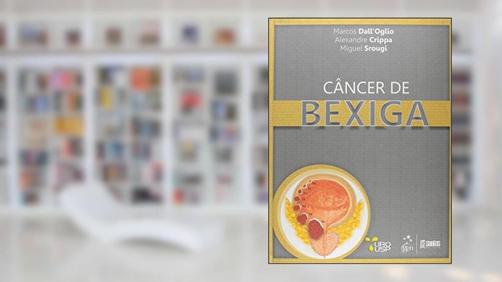 Câncer De Bexiga, do autor MIGUEL SROUGI