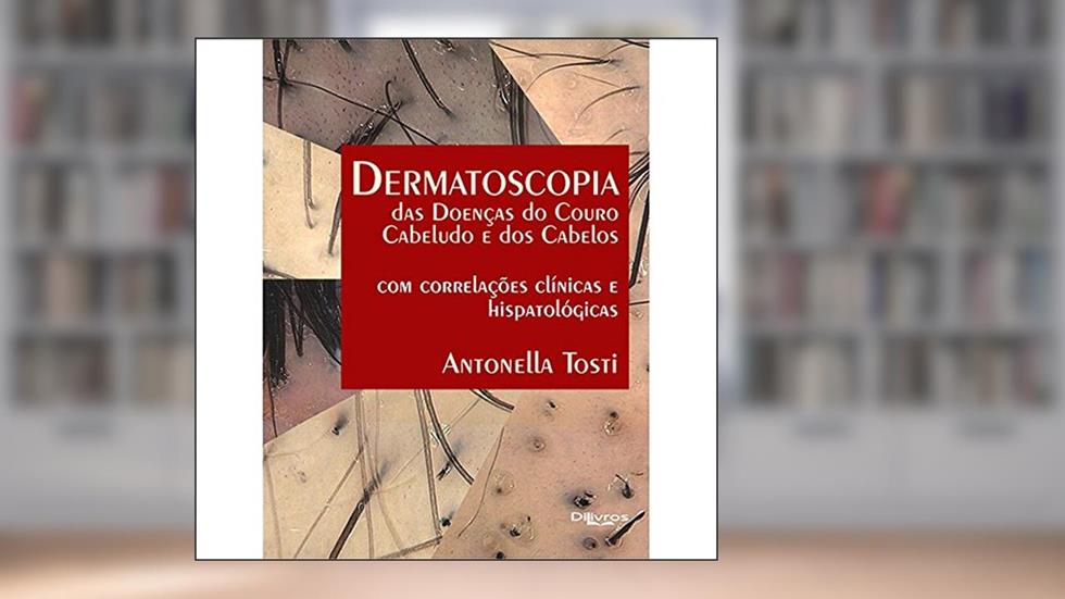 Dermatoscopia das Doenças do Couro Cabeludo e dos Cabelos, do autor Antonella Tosti