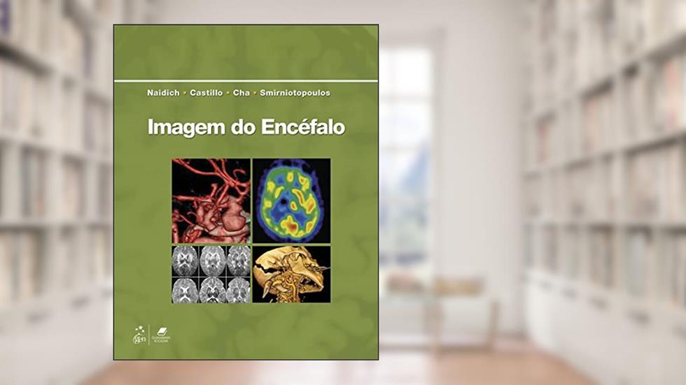 Imagem do Encéfalo, do autor Thomas Thomas P. Naidich