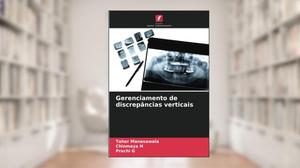 Gerenciamento de discrepâncias verticais, do autor Taher Manasawala; Chinmaya H; Prachi G
