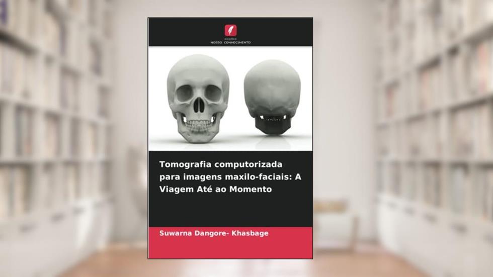 Tomografia computorizada para imagens maxilo-faciais: A Viagem Até ao Momento, do autor Suwarna Dangore- Khasbage