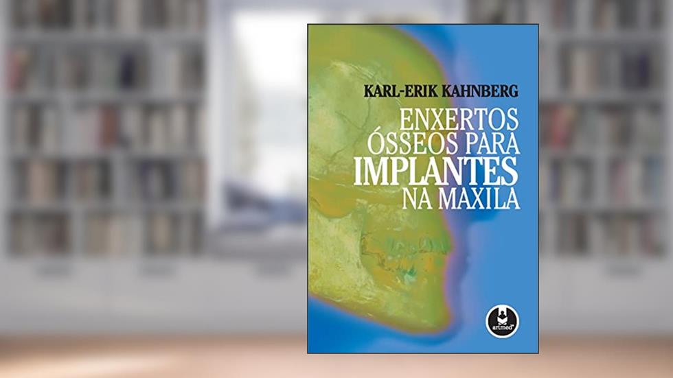 Enxertos Ósseos para Implantes na Maxila, do autor Karl-Erik Kahnberg