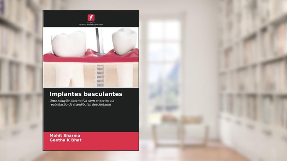 Implantes basculantes: Uma solução alternativa sem enxertos na reabilitação de mandíbulas desdentadas, do autor Mohit Sharma; Geetha K Bhat