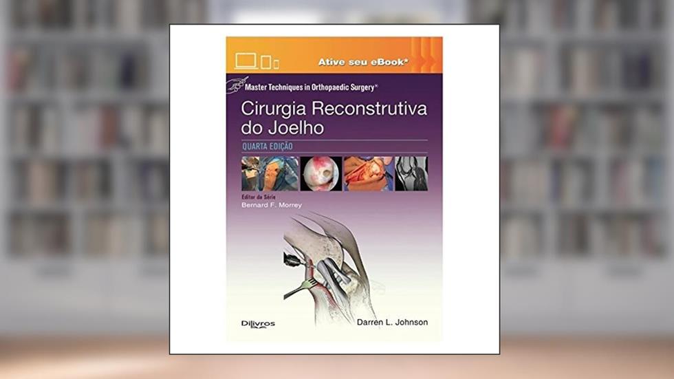 Cirurgia Reconstrutiva Do Joelho Master Techniques In Orthopaedic Surgery, do autor Darren L Johnson