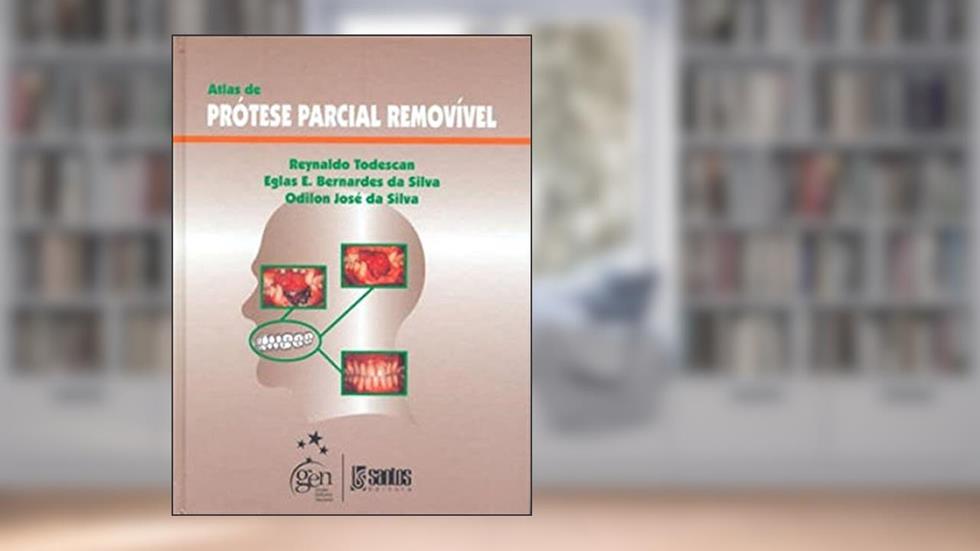Atlas de Prótese Parcial Removível, do autor R Todescan