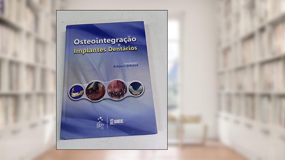 Osteointegracao E Implantes Dentarios, do autor Asbjorn Jokstad