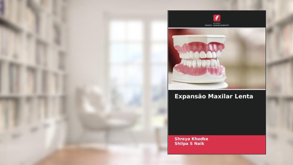 Expansão Maxilar Lenta, do autor Shreya Khodke; Shilpa S Naik