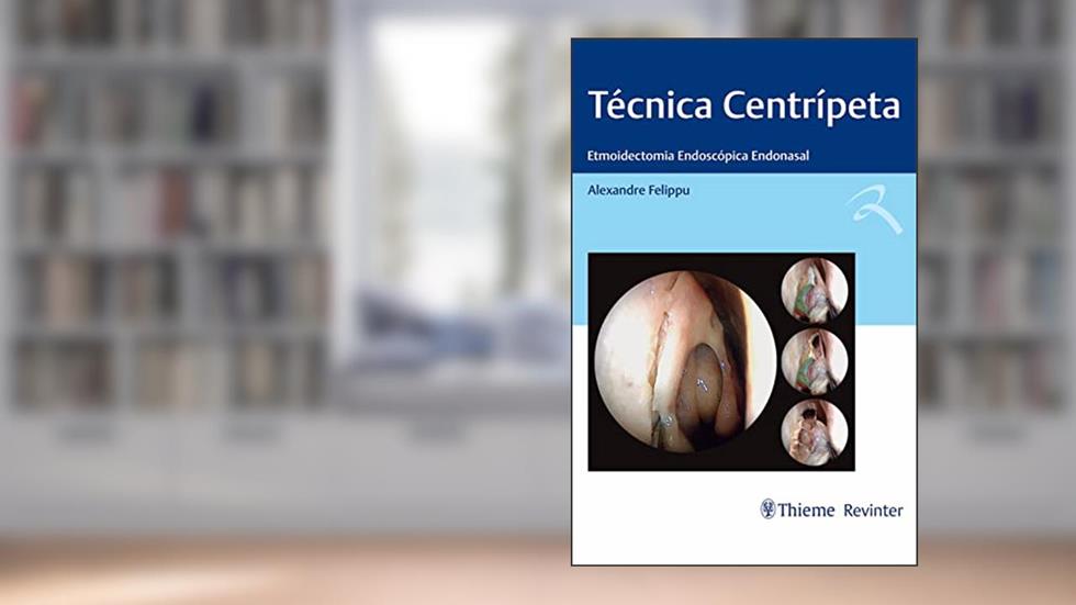Técnica Centrípeta: Etmoidectomia Endoscópica Endonasal, do autor Alexandre Felippu