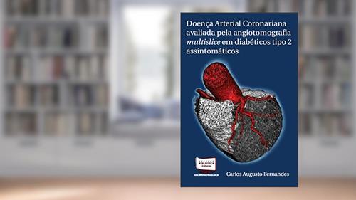 Capa de Doença Arterial Coronariana Avaliada Pela Angiotomografia Multislice em Diabéticos Tipo 2 Assintomáticos, do autor Carlos Augusto Fernandes Tavares