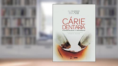 Capa de Cárie dentária: fisiopatologia e tratamento, do autor Ole Fejerskov; Bente Nyvad; Edwina Kidd