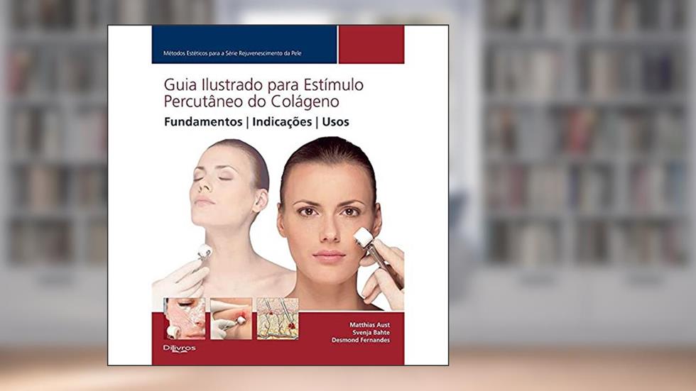 Guia Ilustrado Para Estimulo Percutâneo Do Colágeno, do autor Matthias Aust Svenja Bahte Desmond Fernandes