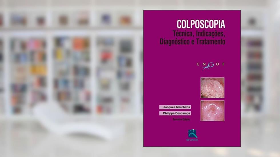 Colposcopia: Técnica, Indicações, Diagnóstico e Tratamento, do autor Jacques Marchetta