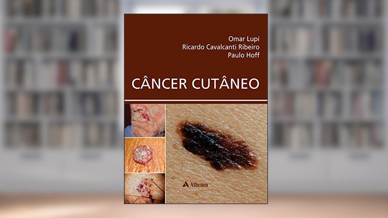 Câncer Cutâneo, do autor Ricardo Cavalcanti Ribeiro; Paulo M. Hoff Omar Lupi