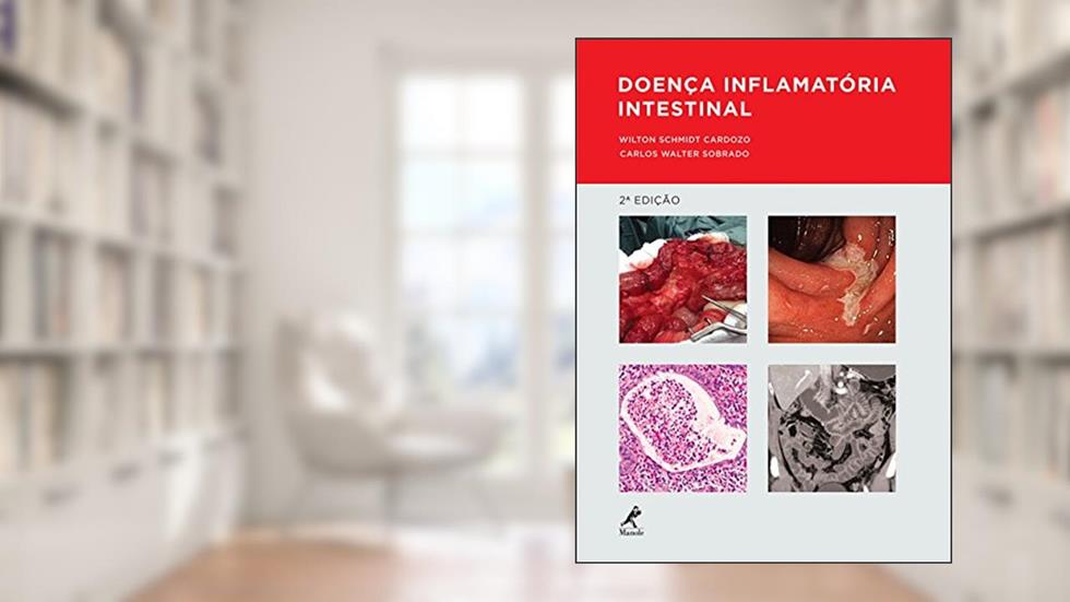 Doença inflamatória intestinal, do autor Wilton Schmidt Cardozo; Carlos Walter Sobrado