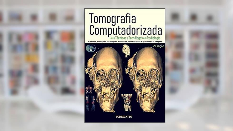 Tomografia Computadorizada, do autor Prof.tito Todescatto