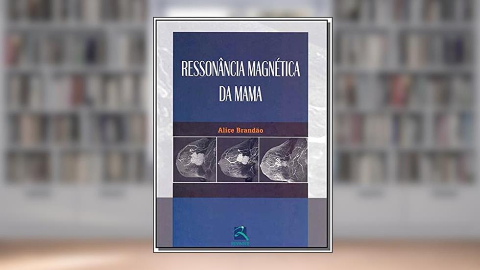 Ressonância Magnética da Mama, do autor Alice Brandão