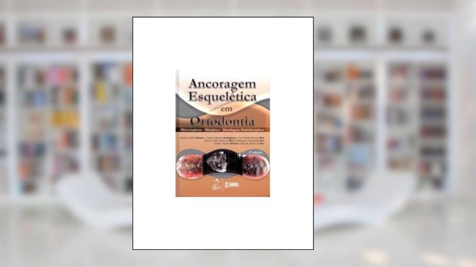 Ancoragem Esquelética em Ortodontia - Mini-implante - Miniplaca - Abordagem Multidisciplinar, do autor Vários autores