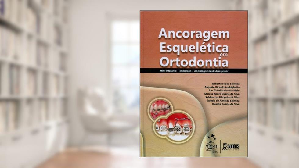 Ancoragem Esquelética em Ortodontia - Mini-Implante - Miniplaca - Abordagem Multidisciplinar, do autor Vários autores