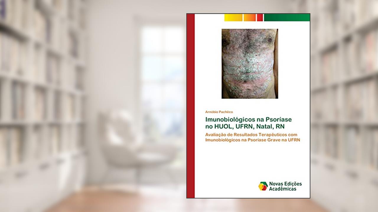 Imunobiológicos na Psoríase no HUOL, UFRN, Natal, RN: Avaliação de Resultados Terapêuticos com Imunobiológicos na Psoríase Grave na UFRN, do autor Arnóbio Pachêco