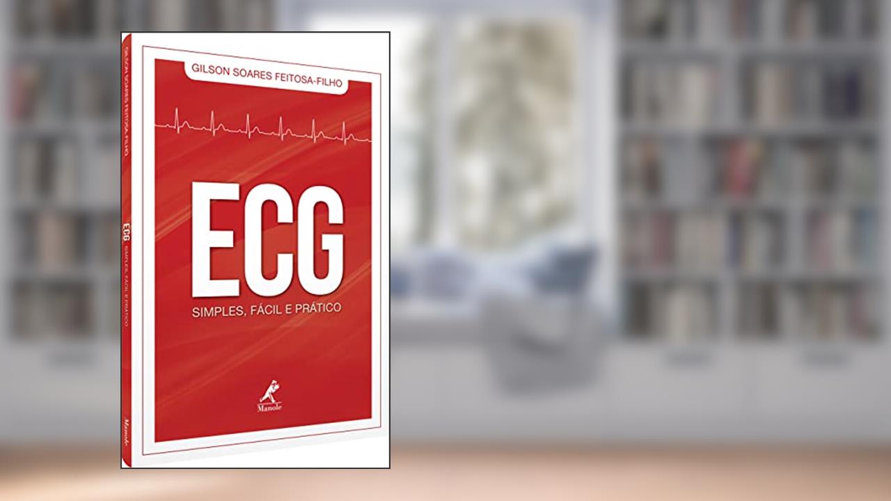 ECG SIMPLES, FÁCIL E PRÁTICO, do autor Gilson Soares Feitosa Filho