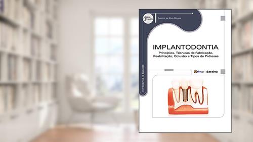 Capa de Implantodontia: Princípios, técnicas de fabricação, reabilitação, oclusão e tipos de próteses, do autor Adelmir da Silva Oliveira