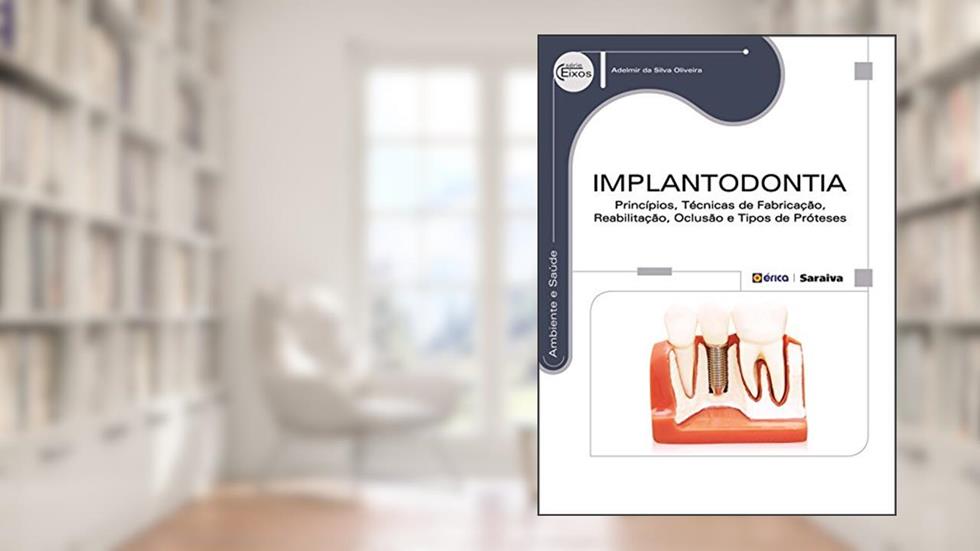 Implantodontia: Princípios, técnicas de fabricação, reabilitação, oclusão e tipos de próteses, do autor Adelmir da Silva Oliveira