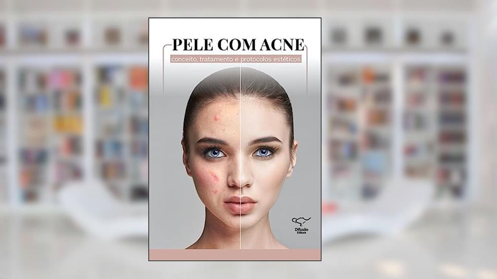 Pele com acne: conceito, tratamento e protocolos estéticos, do autor Cristiane Ribeiro; Regina Gante