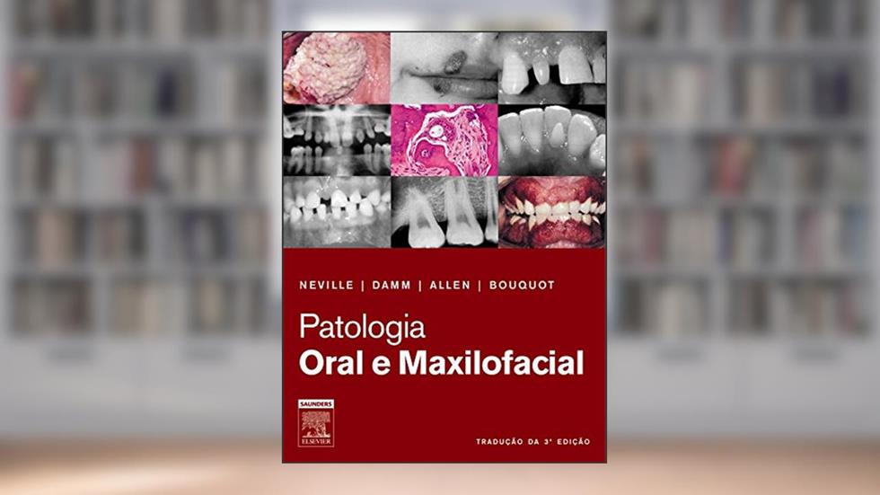 Patologia Oral e Maxilofacial, do autor Allen, Carl M.^Bouquot, Jerry E.^Damm, Douglas D.