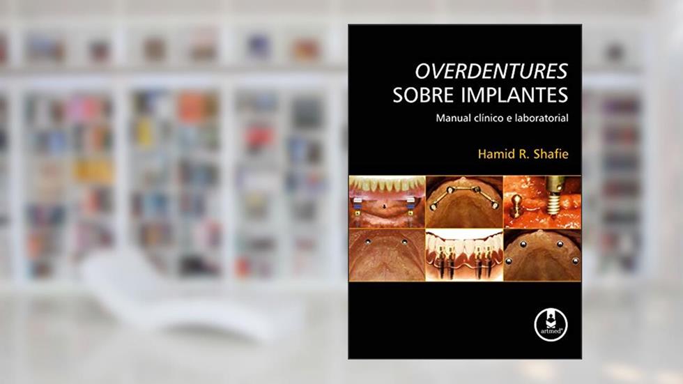 Overdentures Sobre Implantes: Manual Clínico e Laboratorial, do autor Hamid R. Shafie