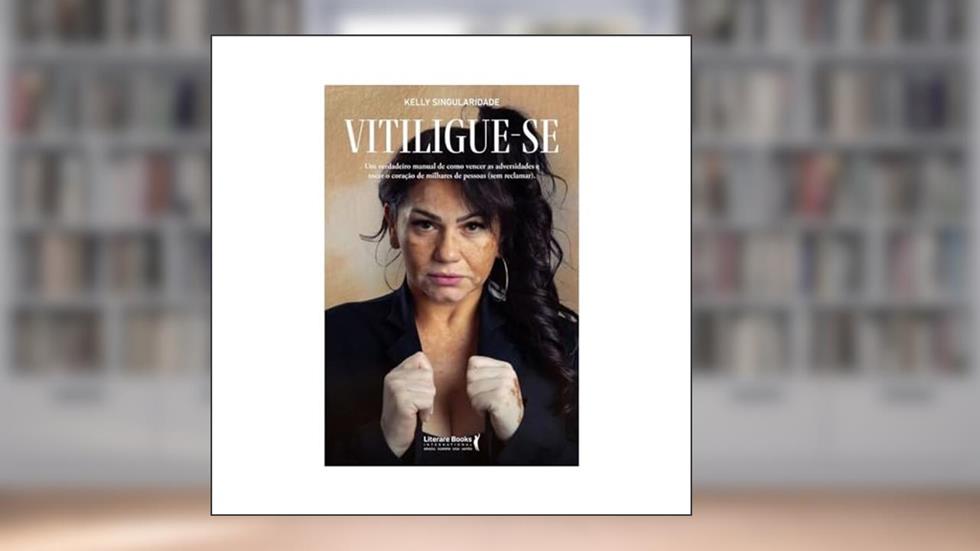 Vitiligue-se: um Verdadeiro Manual de Como Vencer as Adversidades e Tocar o Coração de Milhares de Pessoas (sem Reclamar), do autor Kelly Singularidade
