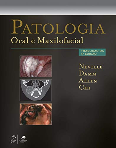 Ler Patologia Oral e Maxilofacial, do autor Brad Brad Neville
