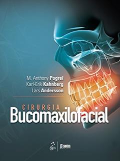 Cirurgia Bucomaxilofacial, do autor M. Anthony Andersson