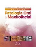 Ler Atlas de Patologia Oral e Maxilofacial, do autor Brad W. et al. NEVILLE