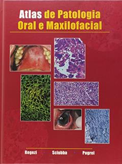 Atlas De Patologia Oral E Maxilofacial, do autor JOSEPH A. REGEZI