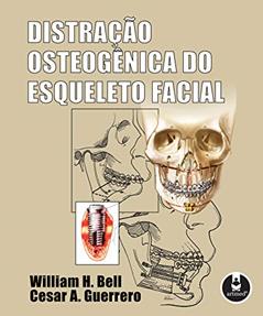 Distração Osteogênica do Esqueleto Facial, do autor William H. Bell; Cesar A. Guerrero