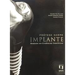 Prótese Sobre Implante. Baseado em Evidências Científicas, do autor Eduardo Piza Pellizzer