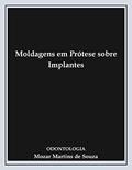 Ler Moldagens em Prótese sobre Implantes: Prótese Odontológica, do autor Mozar Martins