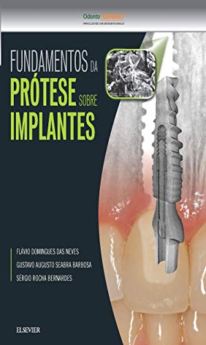 Ler Fundamentos da prótese sobre implantes, do autor Gustavo Barbosa Ler Fundamentos da prótese sobre implantes, do autor Gustavo Barbosa