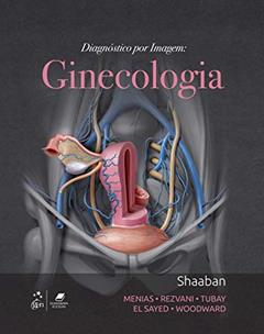 Diagnóstico por Imagem: Ginecologia, do autor Akram Akram M Shaaban