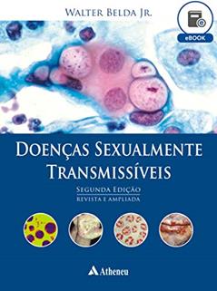 Doenças Sexualmente Transmissíveis - 2ª Edição (eBook), do autor Walter Belda Júnior