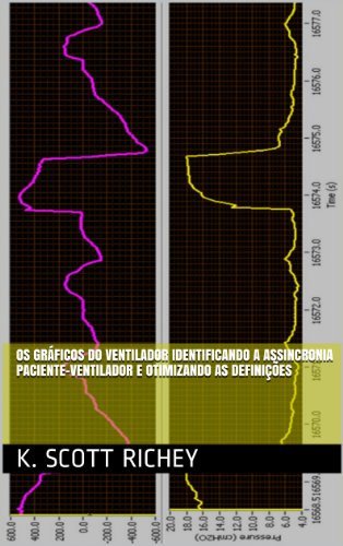 Ler Os Gráficos do Ventilador Identificando a Assincronia Paciente-Ventilador e Otimizando as Definições, do autor K. Scott Richey Ler Os Gráficos do Ventilador Identificando a Assincronia Paciente-Ventilador e Otimizando as Definições, do autor K. Scott Richey
