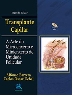 Transplante Capilar: A Arte do Microenxerto, do autor Alfonso Barrera; Carlos Oscar Uebel