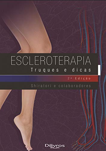 Ler Escleroterapia Truques E Dicas, do autor Arnaldo Yoshimi Shiratori Ler Escleroterapia Truques E Dicas, do autor Arnaldo Yoshimi Shiratori