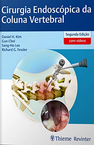 Ler Cirurgia Endoscópica da Coluna Vertebral, do autor Daniel H. Kim; Gun Choi; Sang-Ho Lee; Richard G. Fessler