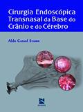 Ler Cirurgia Endoscópica Transnasal da Base do Crânio, do autor Aldo Cassol Stamm