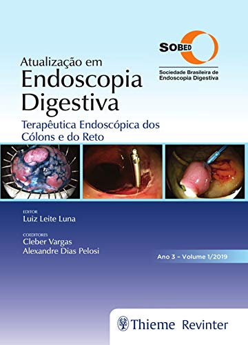 Ler SOBED Atualização em Endoscopia Digestiva: Terapêutica Endoscópica dos Cólons e do Reto: Volume 1, do autor Luiz Leite Luna