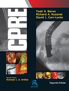 CPRE: Colangiopancreatografia Retrograda Endoscópica, do autor Todd H. Baron