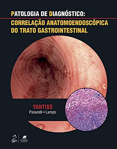 Ler Patalogia de Diagnóstico: Correlação Anatomoendoscópica do Trato Gastrointestinal, do autor Rhonda Rhonda Yantiss Ler Patalogia de Diagnóstico: Correlação Anatomoendoscópica do Trato Gastrointestinal, do autor Rhonda Rhonda Yantiss